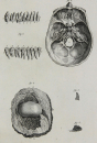 Diderot, Denis - Encyclopedie - "Anatomie" -...