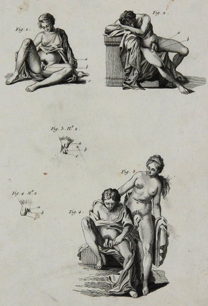 Diderot, Denis - "Histoire Naturelle" - Hermaphrodites 1