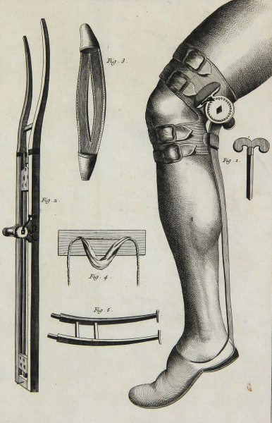 Diderot, Denis - Encyclopedie - "Chirurgie" - Achillessehne