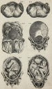 Hall, William Henry - Encyclopedia - "Anatomie"...